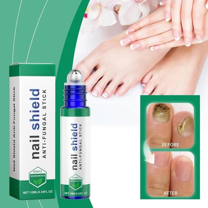 Nail Shield™ Anti-Fungal Roll-On – 10ml