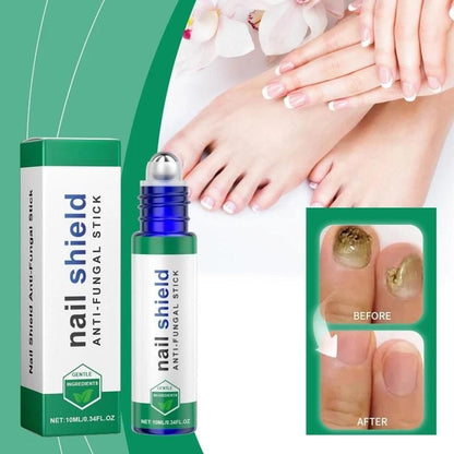 Nail Shield™ Anti-Fungal Roll-On – 10ml
